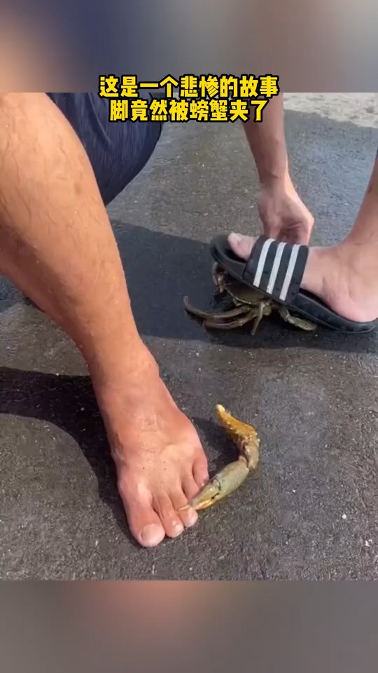 这是一个悲惨的故事，脚竟然被螃蟹夹了
