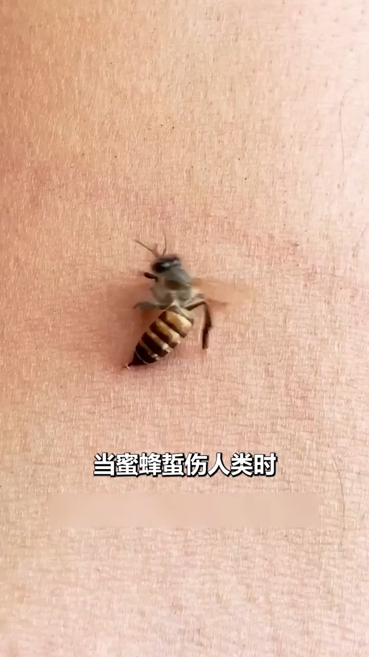 蜜蜂蜇人后，很快会死亡