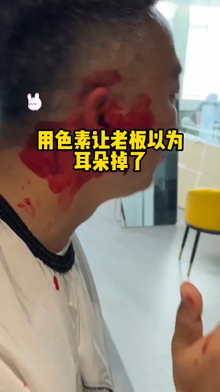 我是真没想到啊 真疼啊 