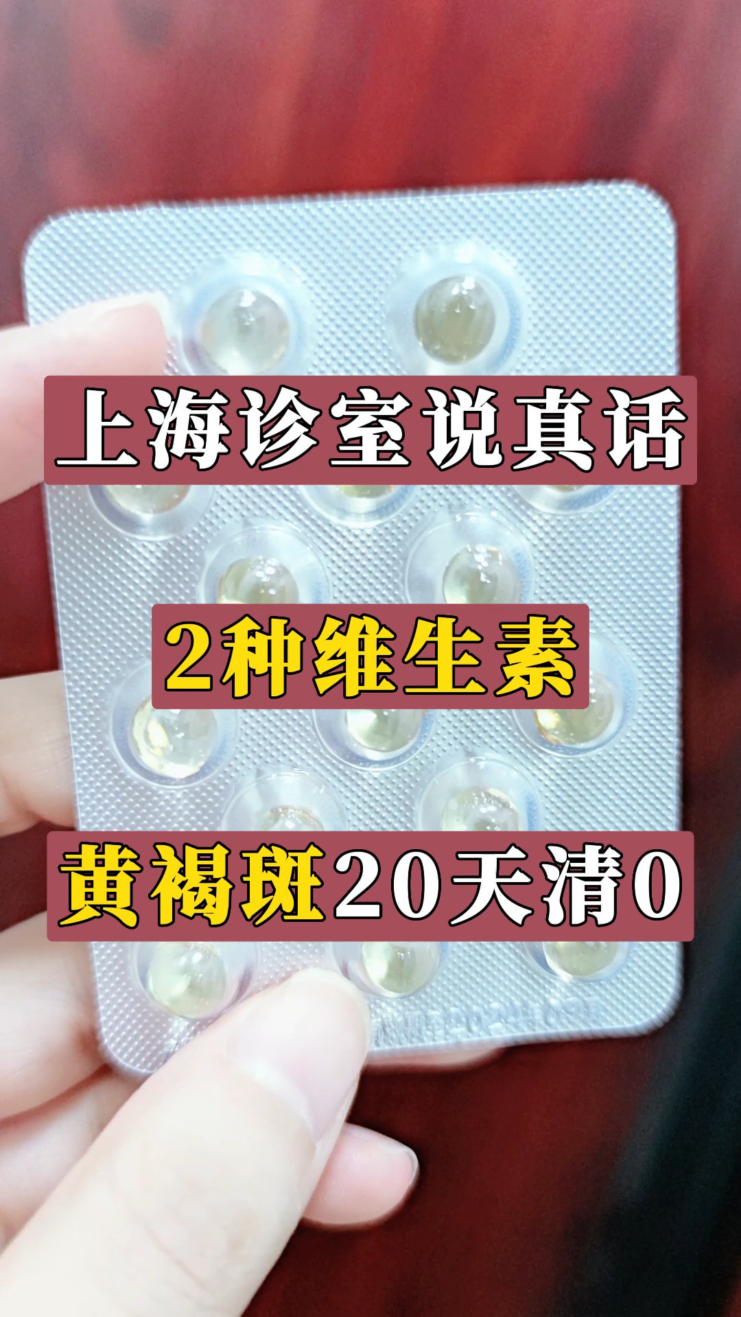 上海诊室说真话,2种维生素,黄褐斑20天清0