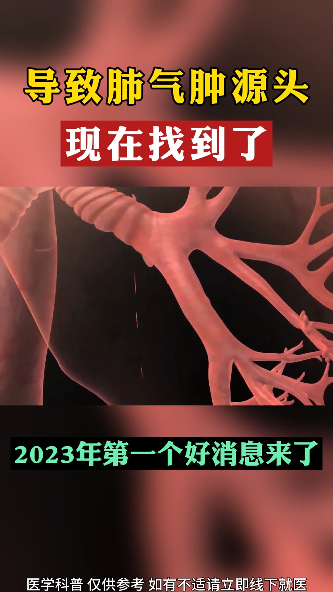 导致肺气肿源头,现在找到了,2023年第一个好消息#医学科普 #健康科普 #中医 