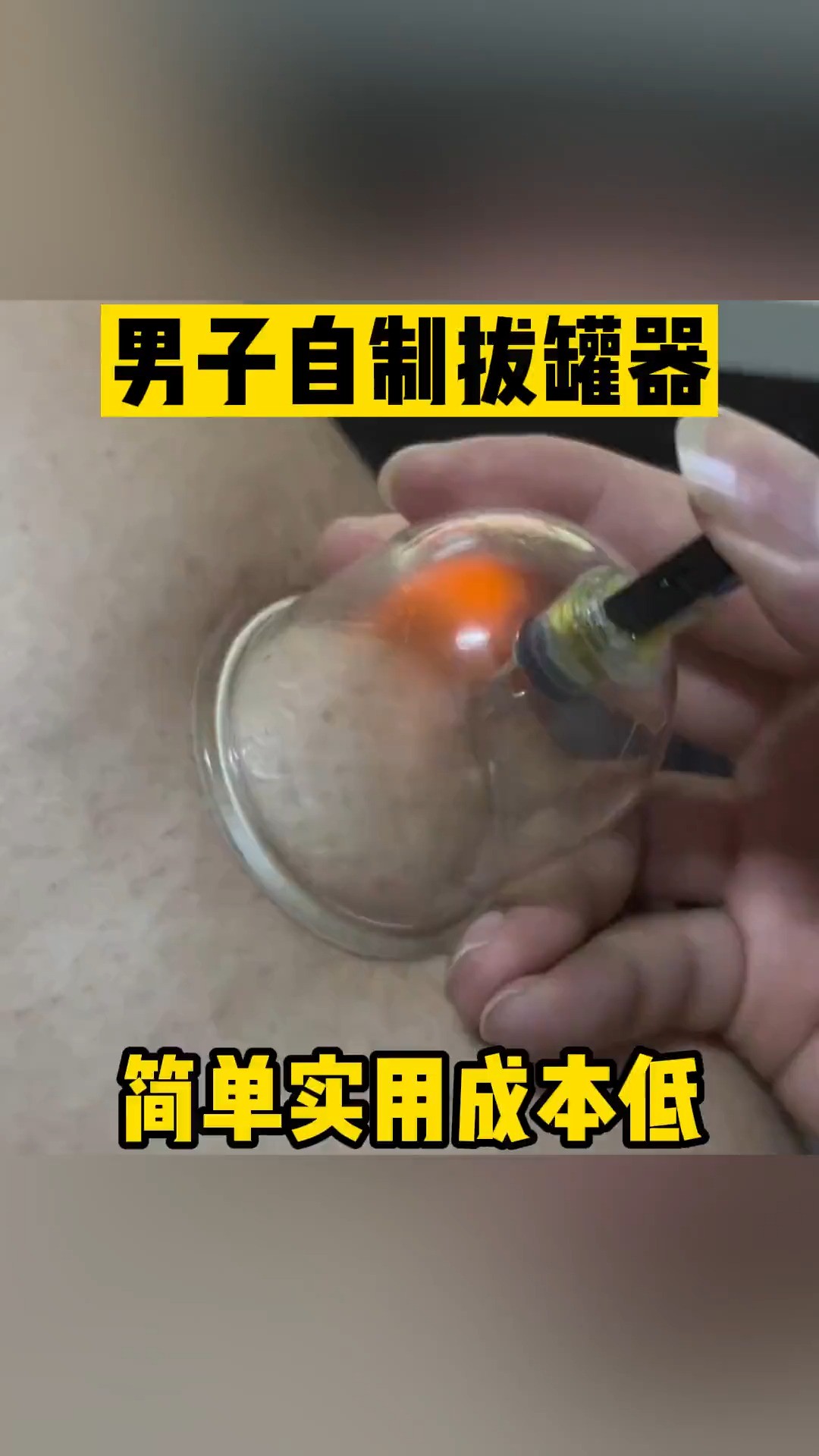 男子自制拔罐器 简单实用成本低