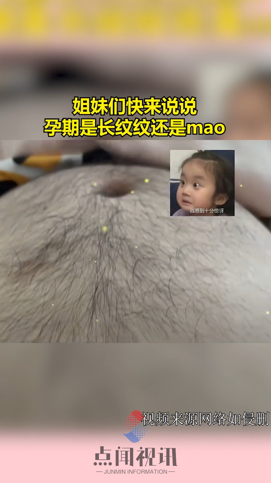 你们孕期长纹纹我的为什么是长毛毛呢? 