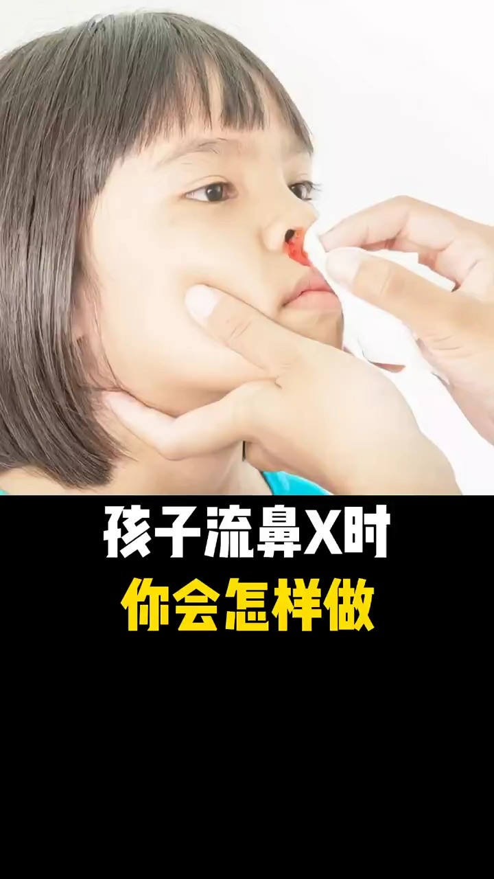 孩子流鼻血时,你知道正确的做法吗?