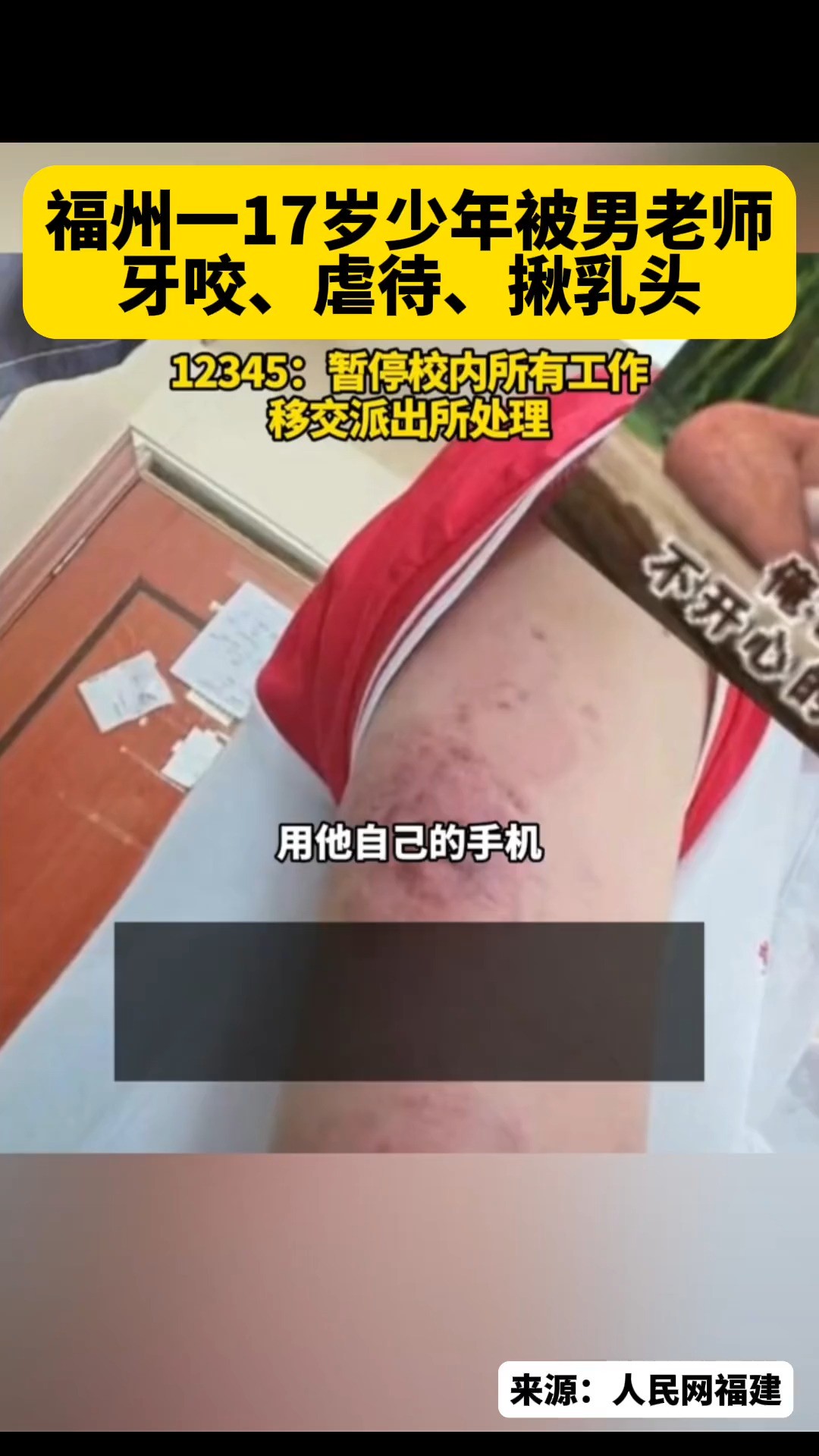 近日,福建福州中华技师学院一学生家长称孩子被男老师牙咬虐待揪乳头. 当地:目前该老师已经被开除,移交派出所处理. #少年被男老师牙咬虐待揪乳头...