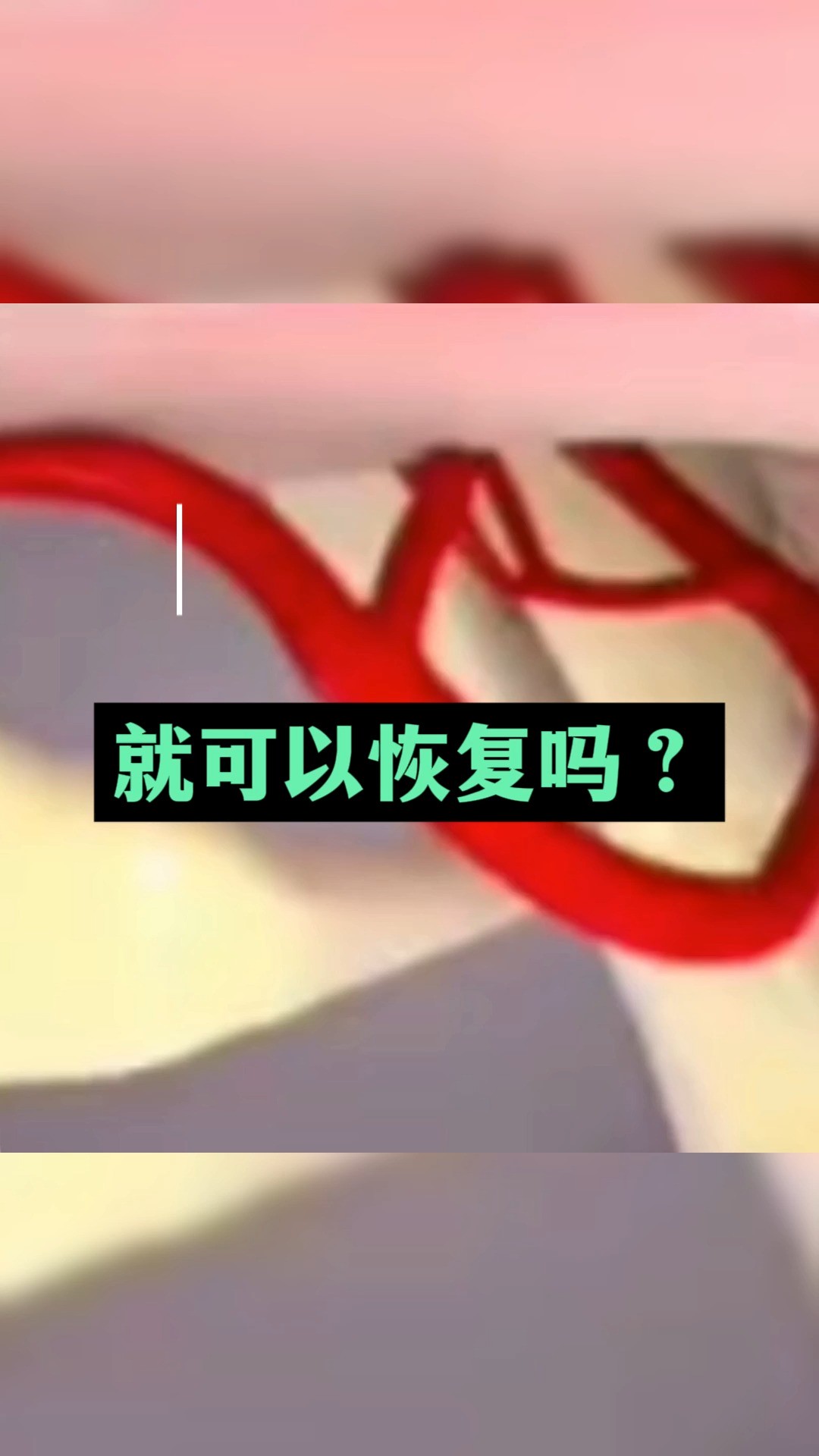 面瘫后贴活血的膏药就可以恢复吗?#面瘫