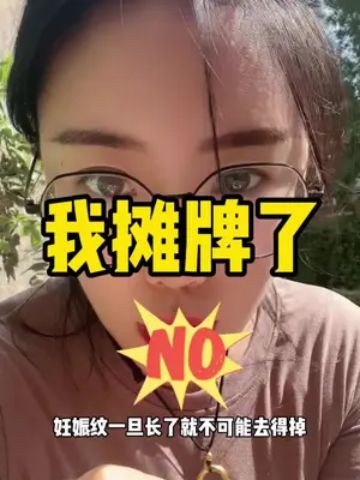 我摊牌了姐妹们,3个预防妊娠纹的方法,咱就是要从源头上避免! 