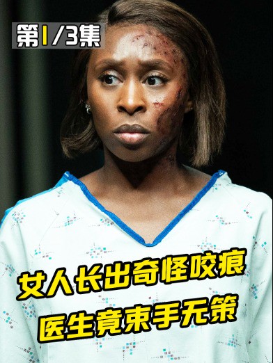 1.女人长出奇怪咬痕,医生竟束手无策1#经典影视考古计划 