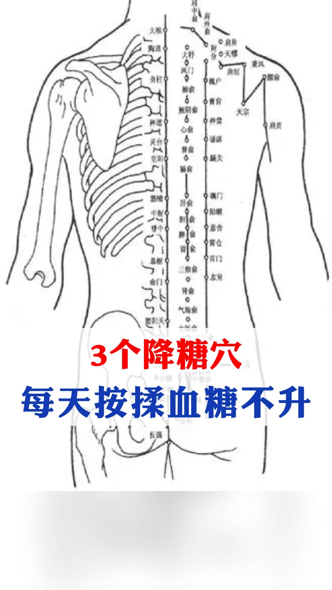 3个降糖穴,每天按操血糖不升