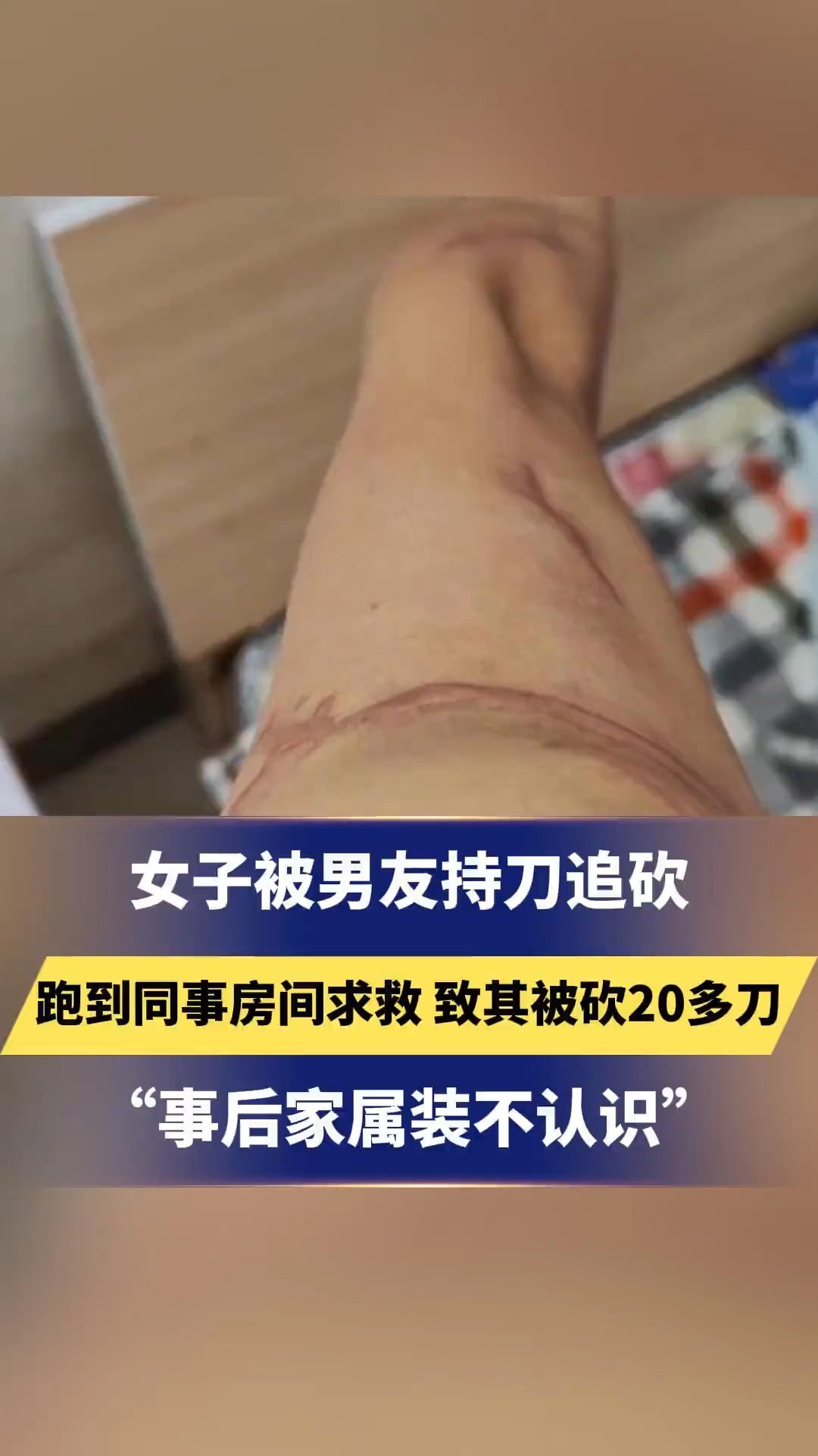 女子被男友持刀追砍,跑到同事房间求救,致其被砍20多刀“事后