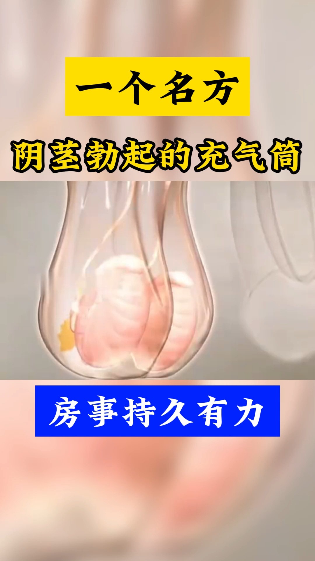 一个名方,阴茎勃起的充气筒,房事持久有力#男性健康 #健康科普 