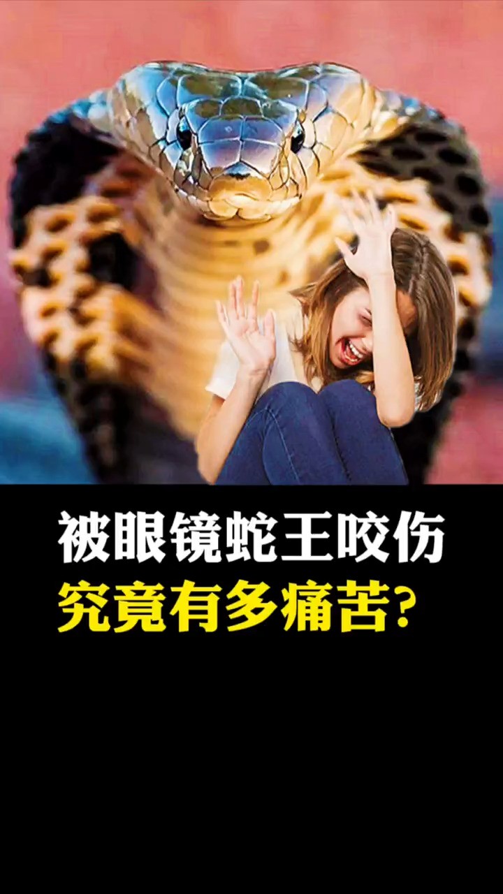 被眼镜王蛇咬伤,究竟有多痛苦?