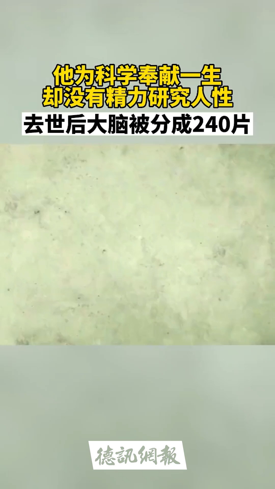 爱因斯坦为科学奉献了一生,死后大脑被切成240片,爱因斯坦曾发明一个著名的质能方程,也就是从狭义相对论开始,质量和能量都是同种物质的不同表...