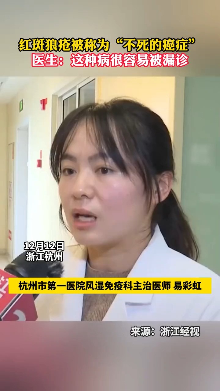 #红斑狼疮 被称为“不死的癌症”,医生:这种病很容易被误诊