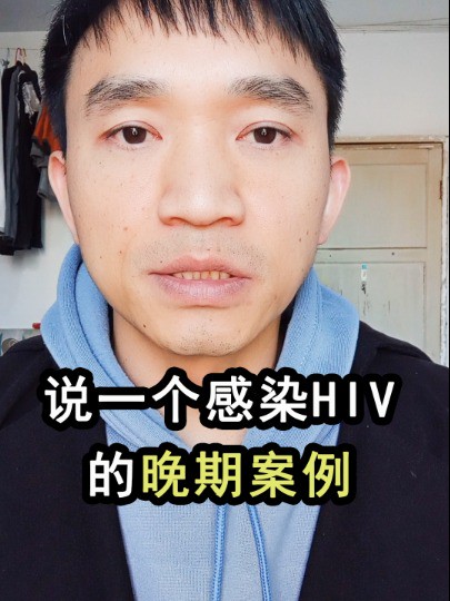 说一个感染hiv的晚期案例,不是吓大家,是真的想提醒每个人#艾滋病#hiv#晏哥抗艾