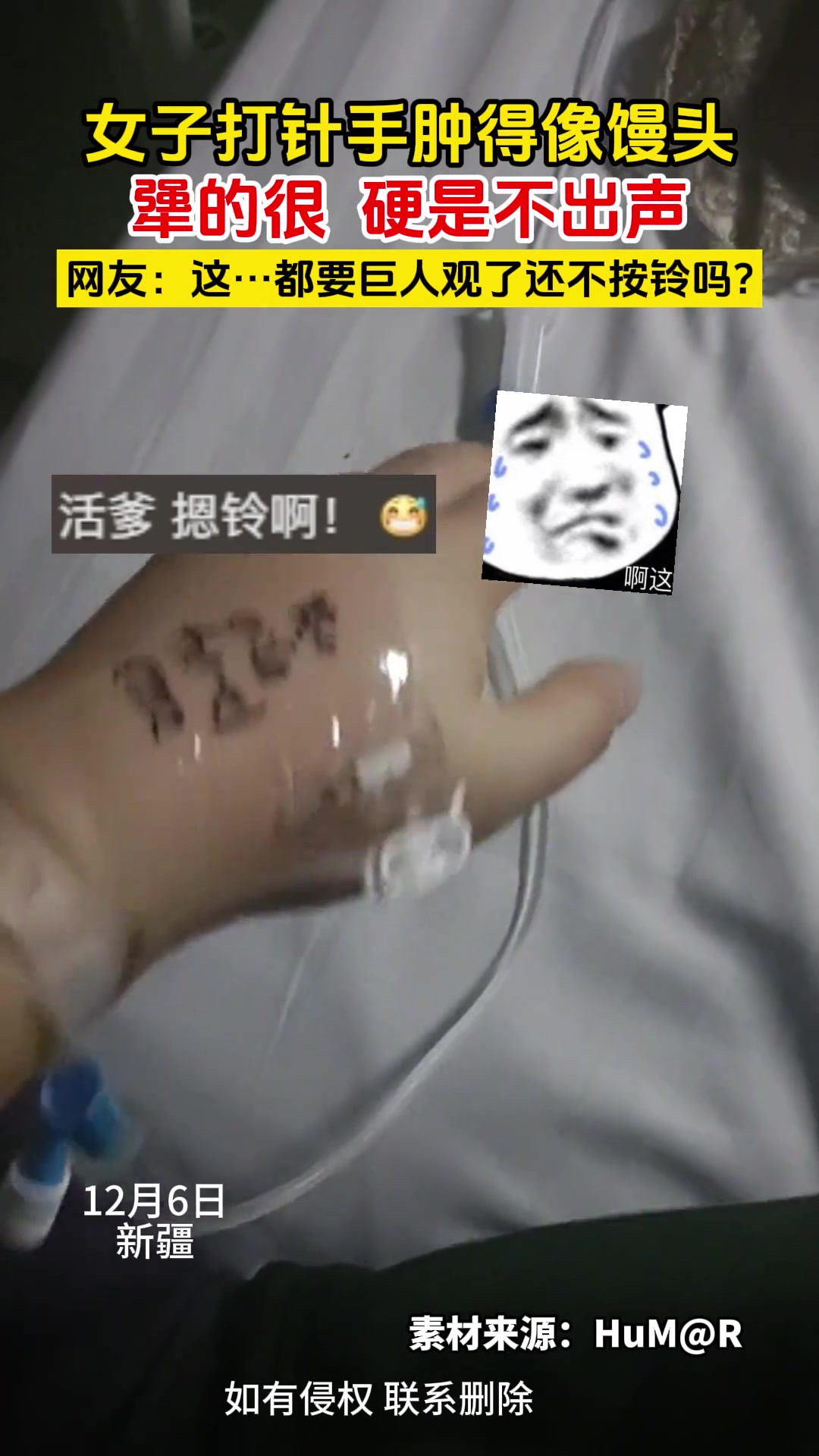 女子打针手肿得像馒头,犟的很 硬是不出声,网友 这…都要巨人观了还不按铃吗