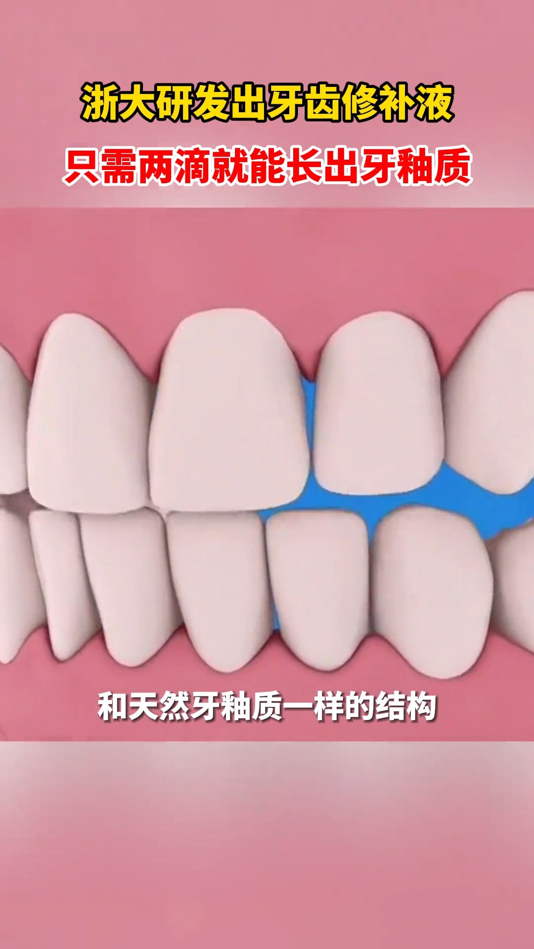 我国浙江大学团队研发出牙齿修补药水,只需滴两滴就能“长”出牙釉质,你期待这样的黑科技到来吗? 