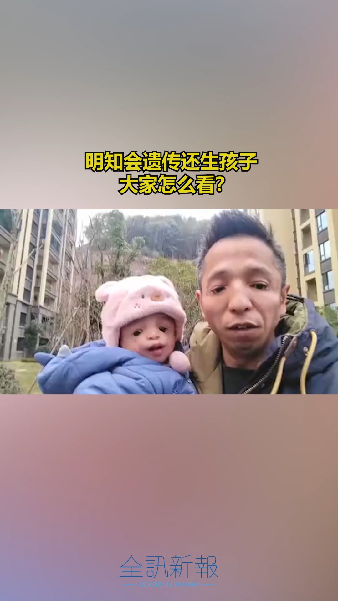 “鸟面综合征”是一种常见染色体显性遗传性疾病