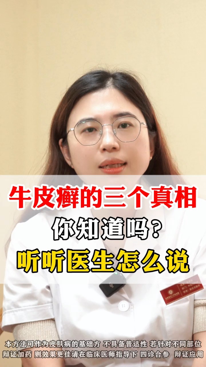 皮肤科孔宇虹:牛皮癣的三个真相,你知道吗?听听医生怎么说