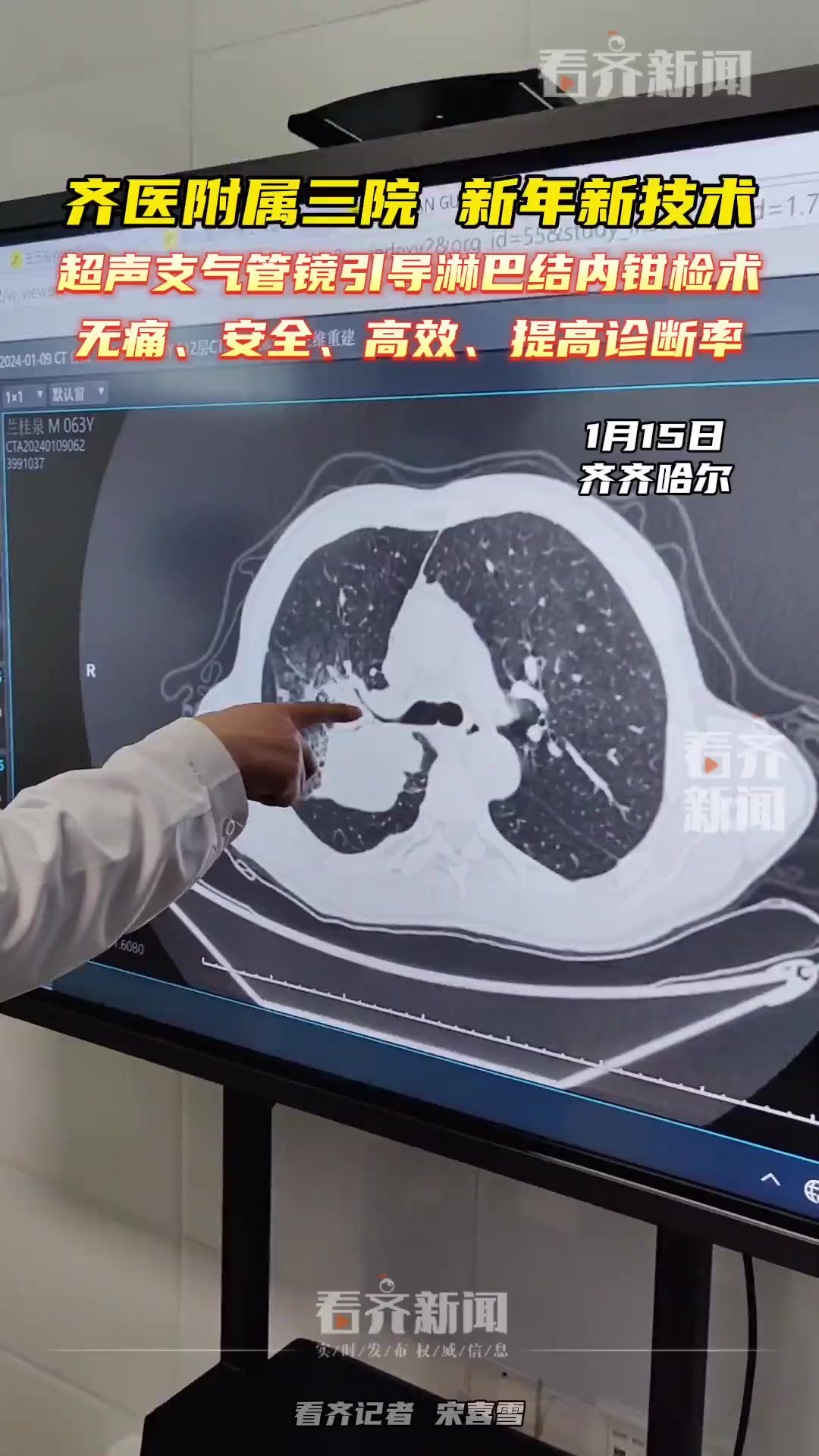 1月15日,齐齐哈尔 齐医附属三院,新年新技术超声支气管镜引导淋巴结内钳检术无痛、安全、高效、提高诊断率……