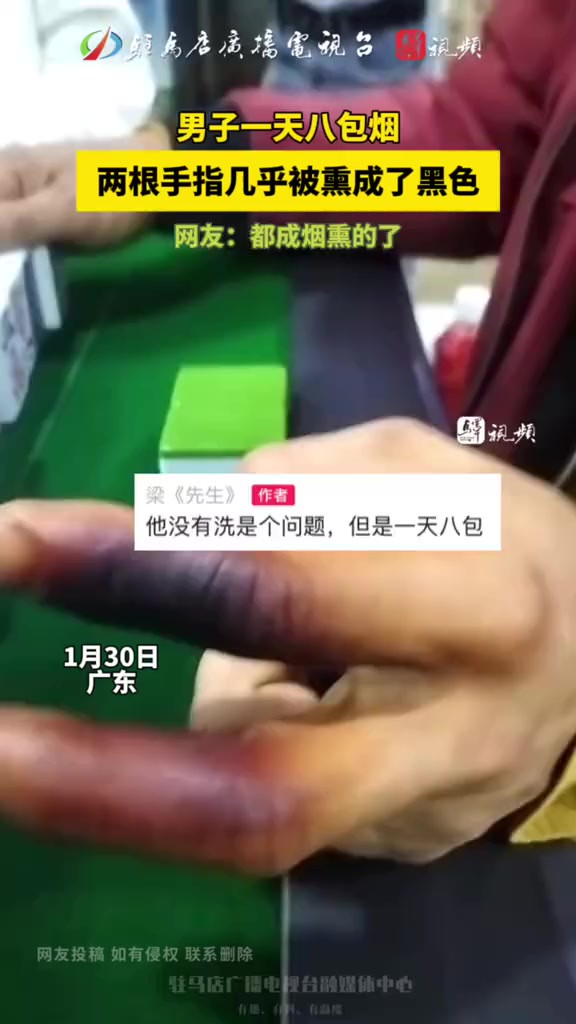 男子一天八包烟 两根手指几乎被熏成了黑色 (来源: