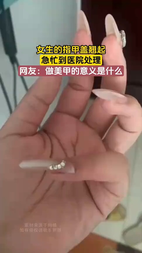 女生的指甲盖翘起,急忙到医院处理,网友:做美甲的意义是什么