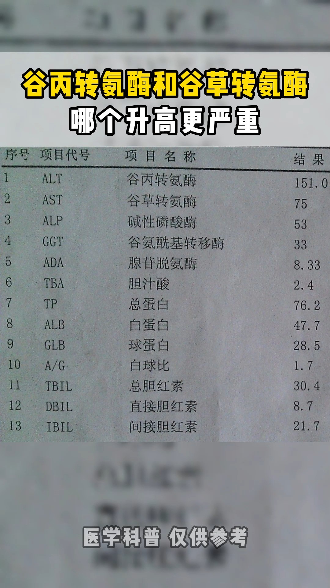 谷草转氨酶和谷丙转氨酶哪个升高更严重