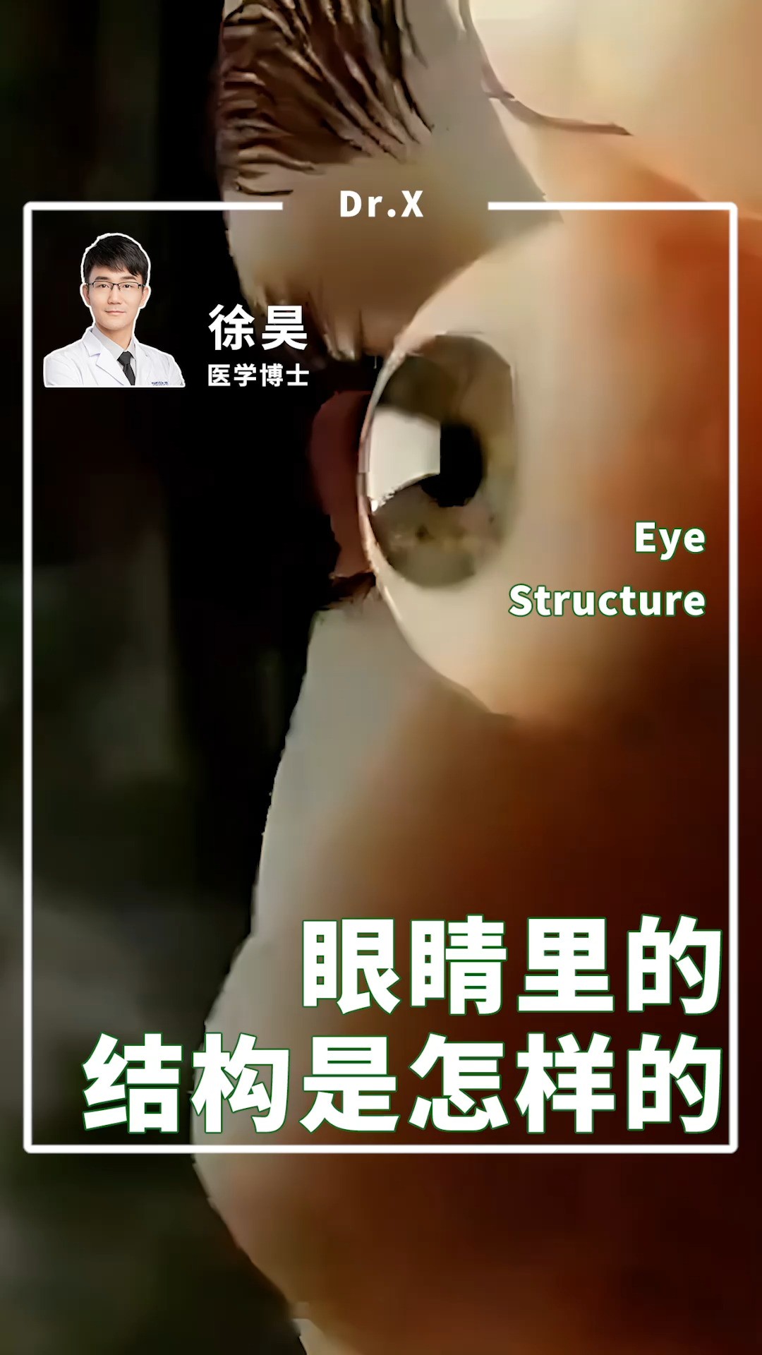 眼睛里的结构?