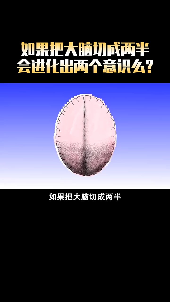  如果把大脑分成两半会发生什么?#科学 #科普 #涨知识