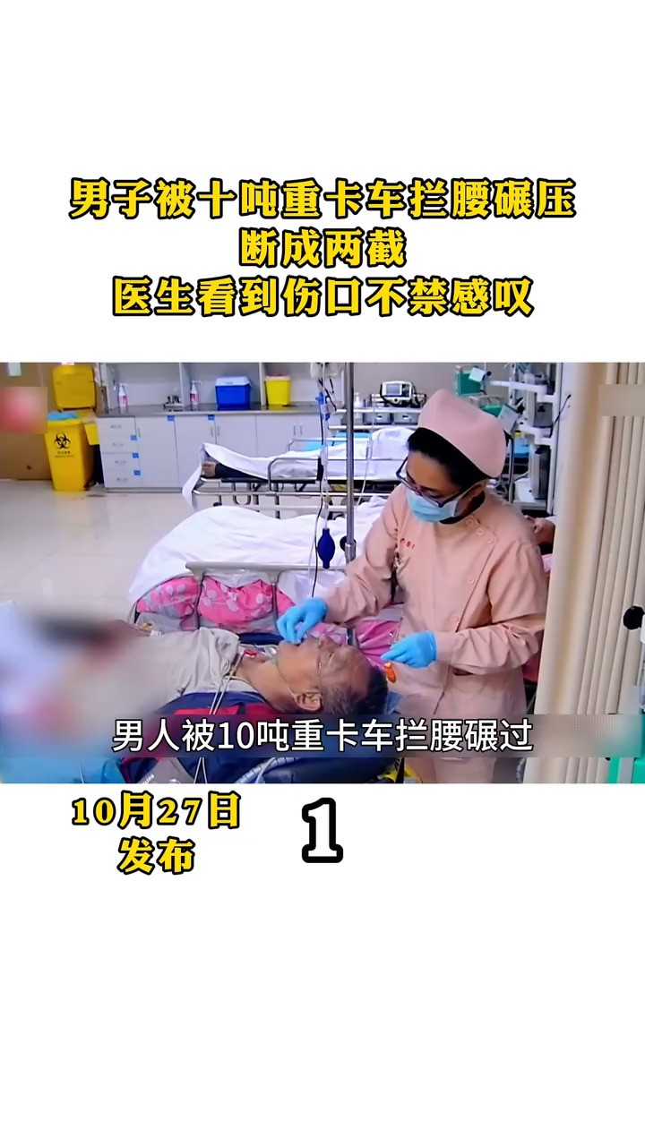 男子被十吨重卡车拦腰碾压 断成两截 医生看到伤口不禁感叹