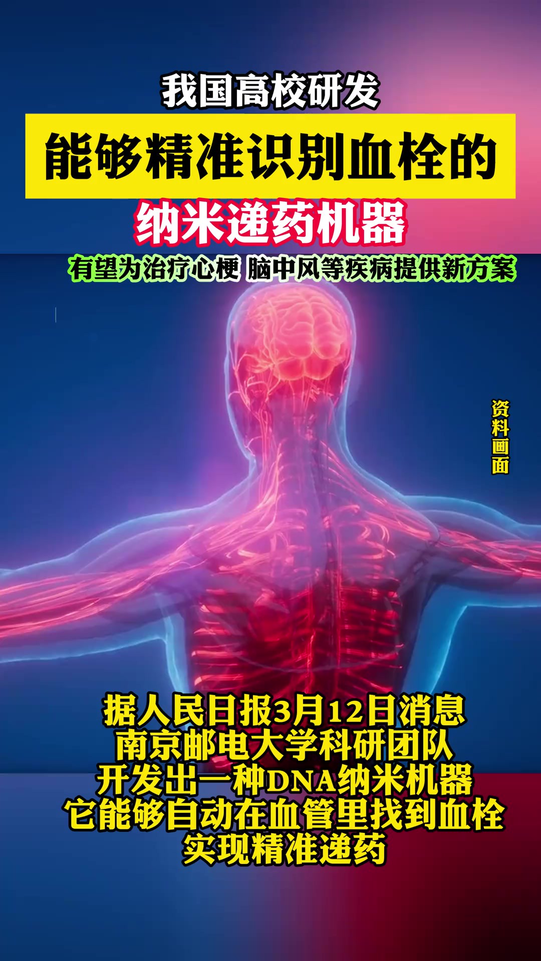 我国高校研发能够精准识别血栓的纳米递药机器