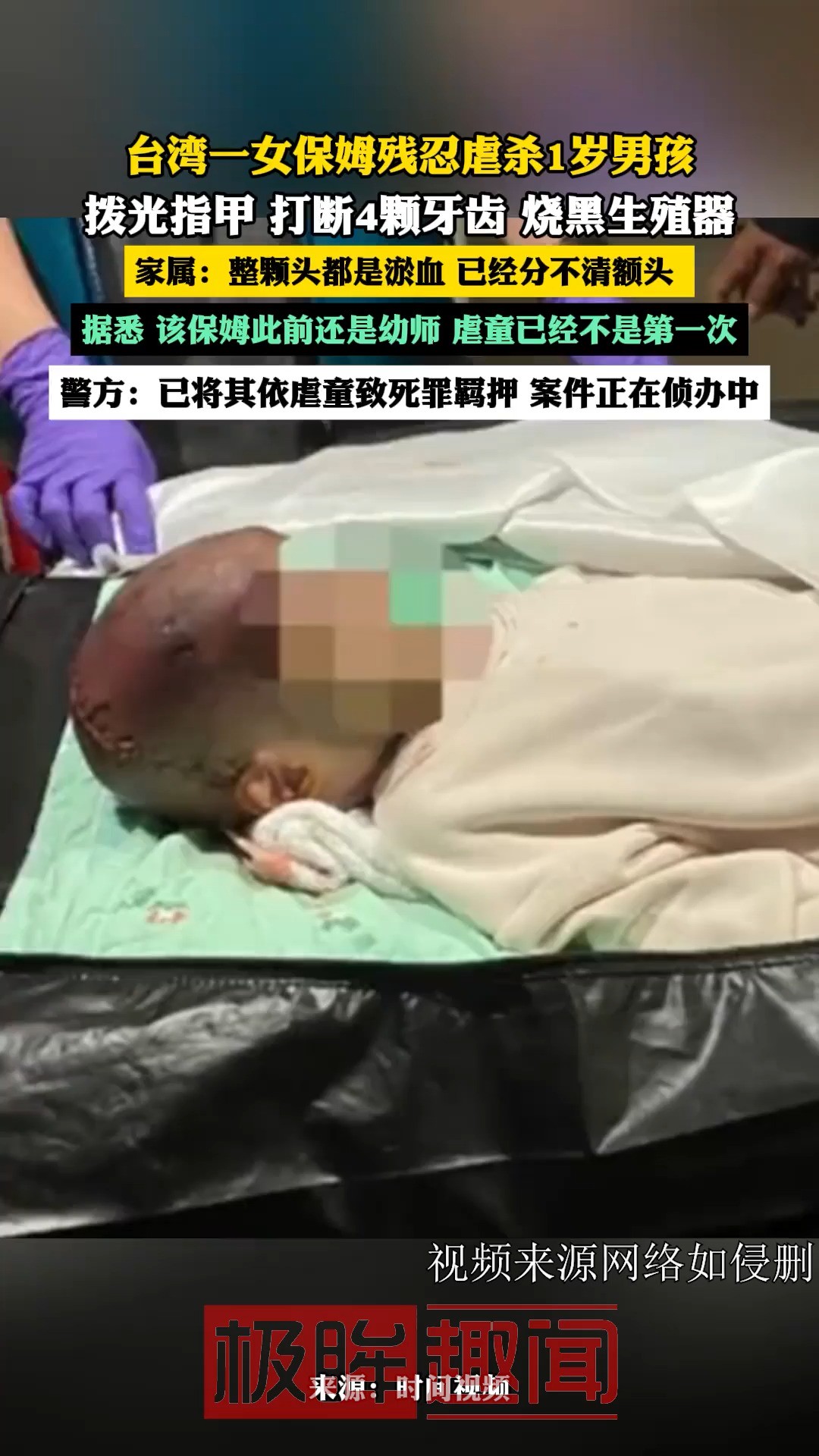 台湾一女保姆残忍虐杀1岁男孩,拨光指甲 打断4颗牙齿 烧黑生殖器