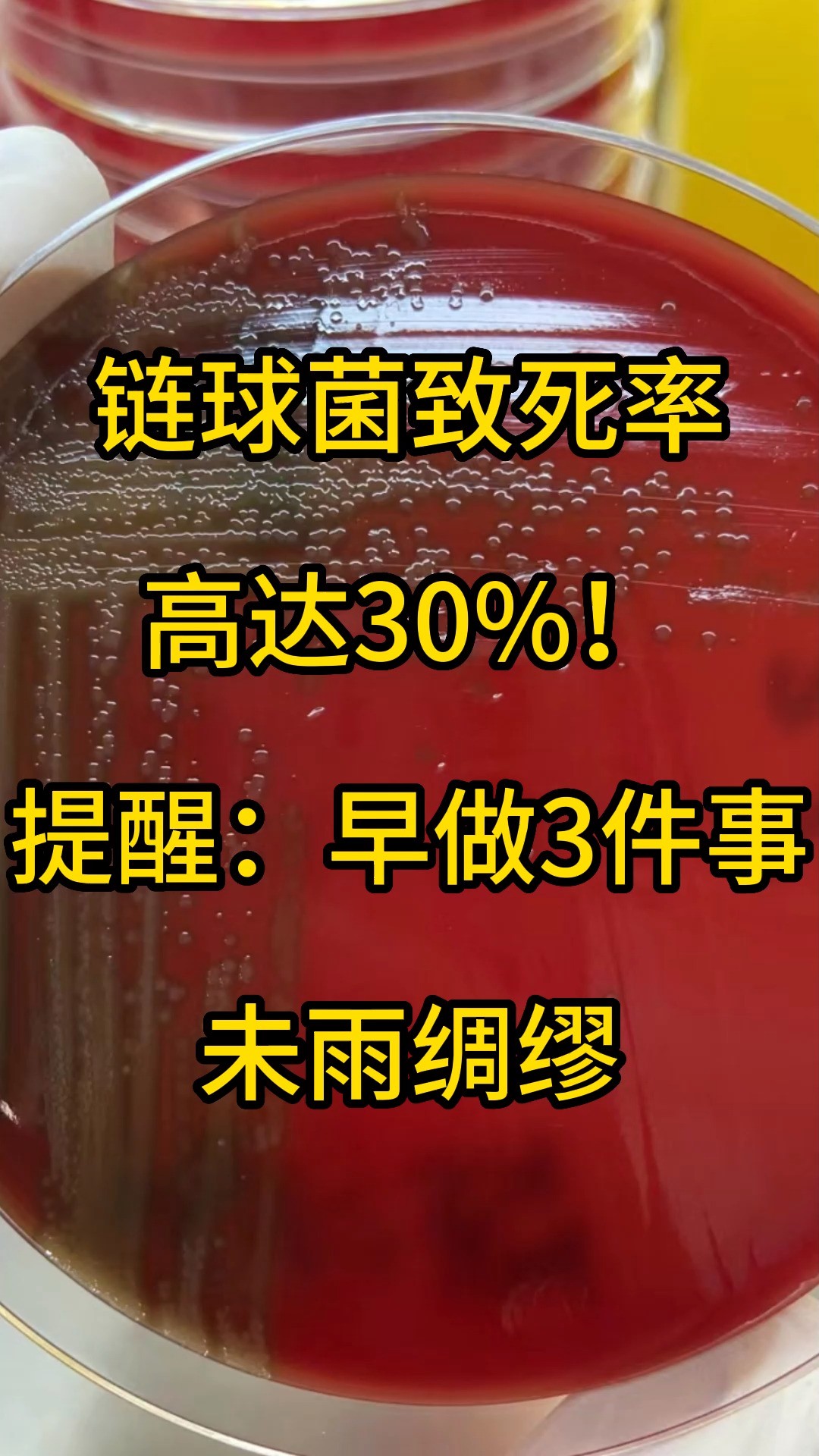 链球菌致死率高达30%!提醒:早做3件事,未雨绸缪