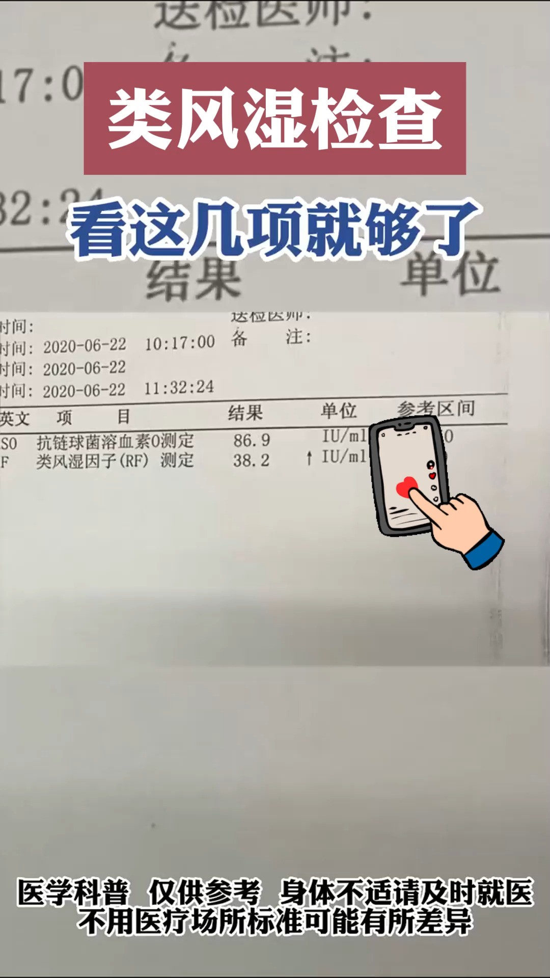 类风湿的检查,做这几项就够了!!