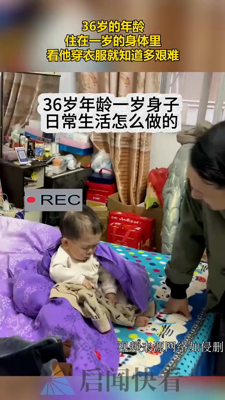 36岁的年龄,住在一岁的身体里,看他穿衣服就知道多艰难