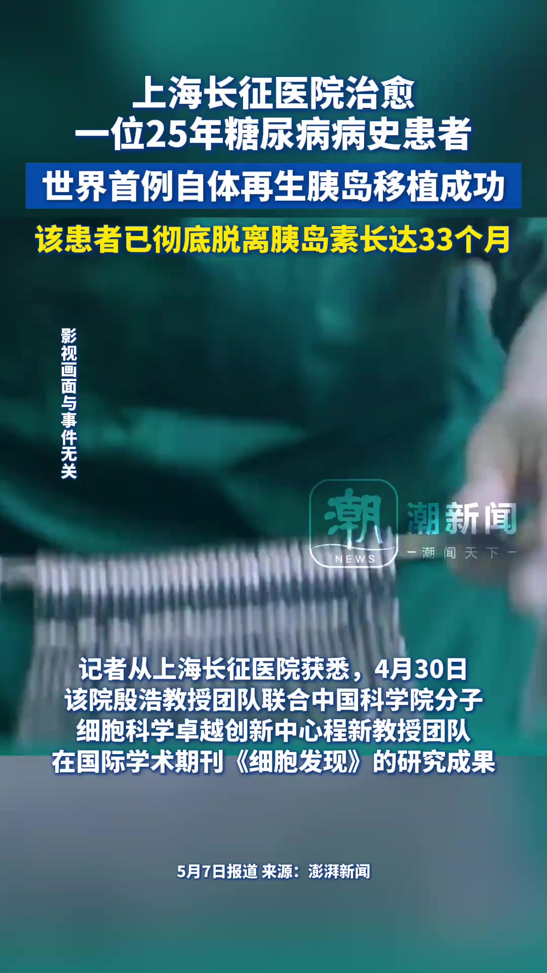 上海长征医院治愈一位25年糖尿病病史患者,世界首例自体再生胰岛移植成功,该患者已彻底脱离胰岛素长达33个月