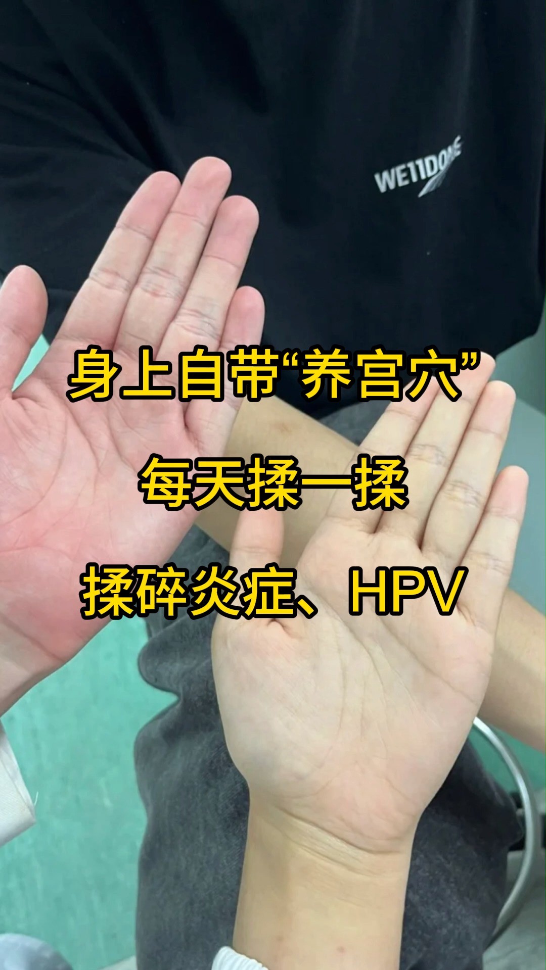 身上自带“养宫穴”,每天揉一揉,揉碎炎症、HPV