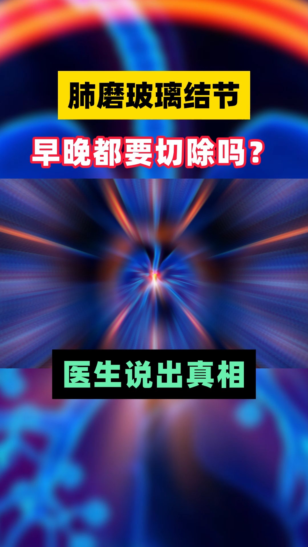 肺磨玻璃结节早晚都要切除吗?医生说出真相