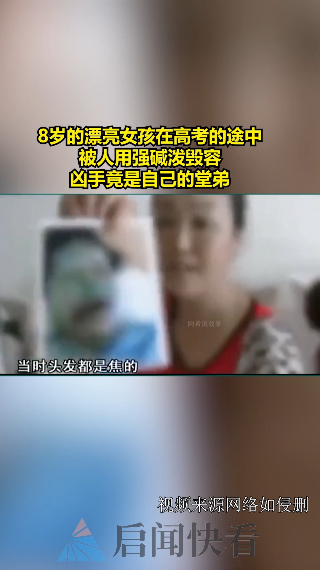 8岁的漂亮女孩在高考的途中,被人用强碱泼毁容,凶手竟是自己的堂弟 