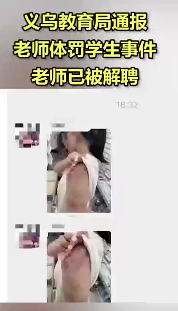 义乌教育局通报老师体罚学生事件 老师已被解聘