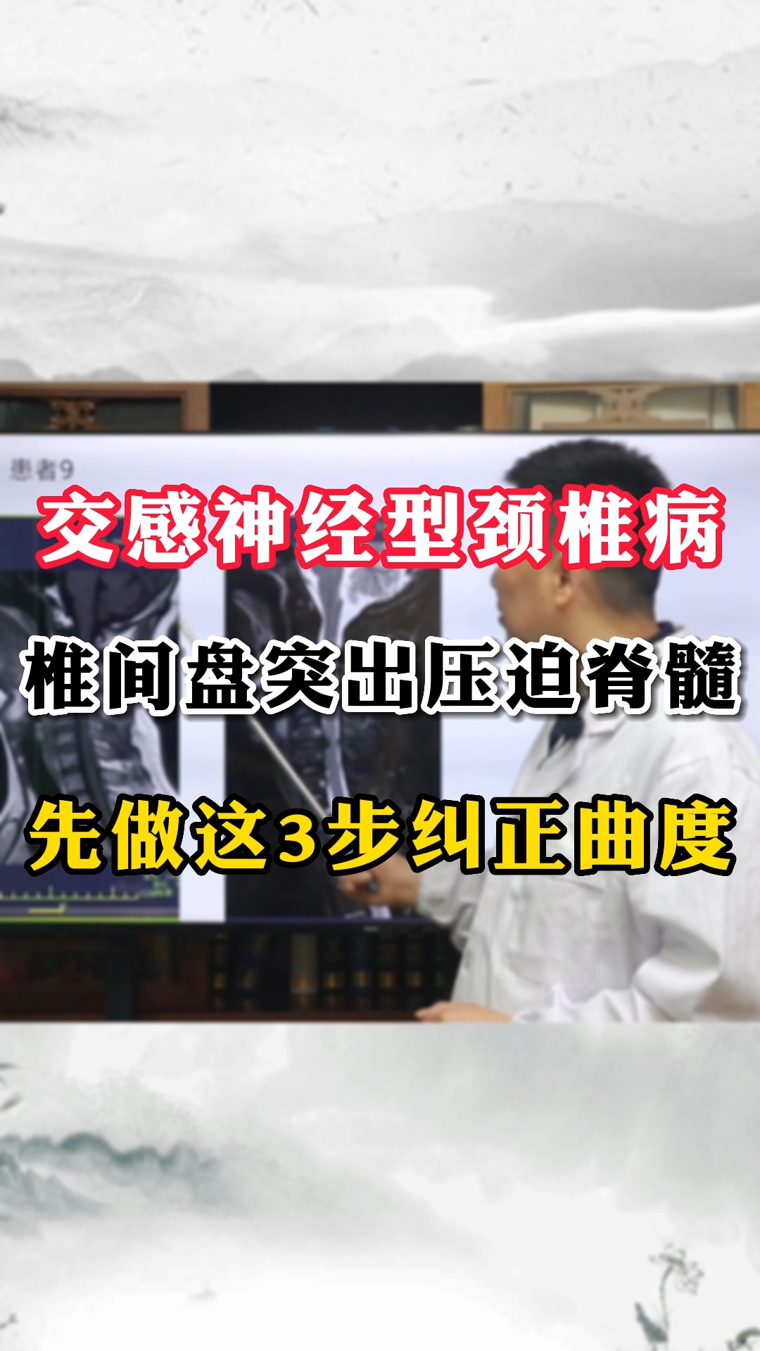 交感神经型颈椎病 颈椎间盘突出压迫脊髓 先做好这3步曲度矫正 