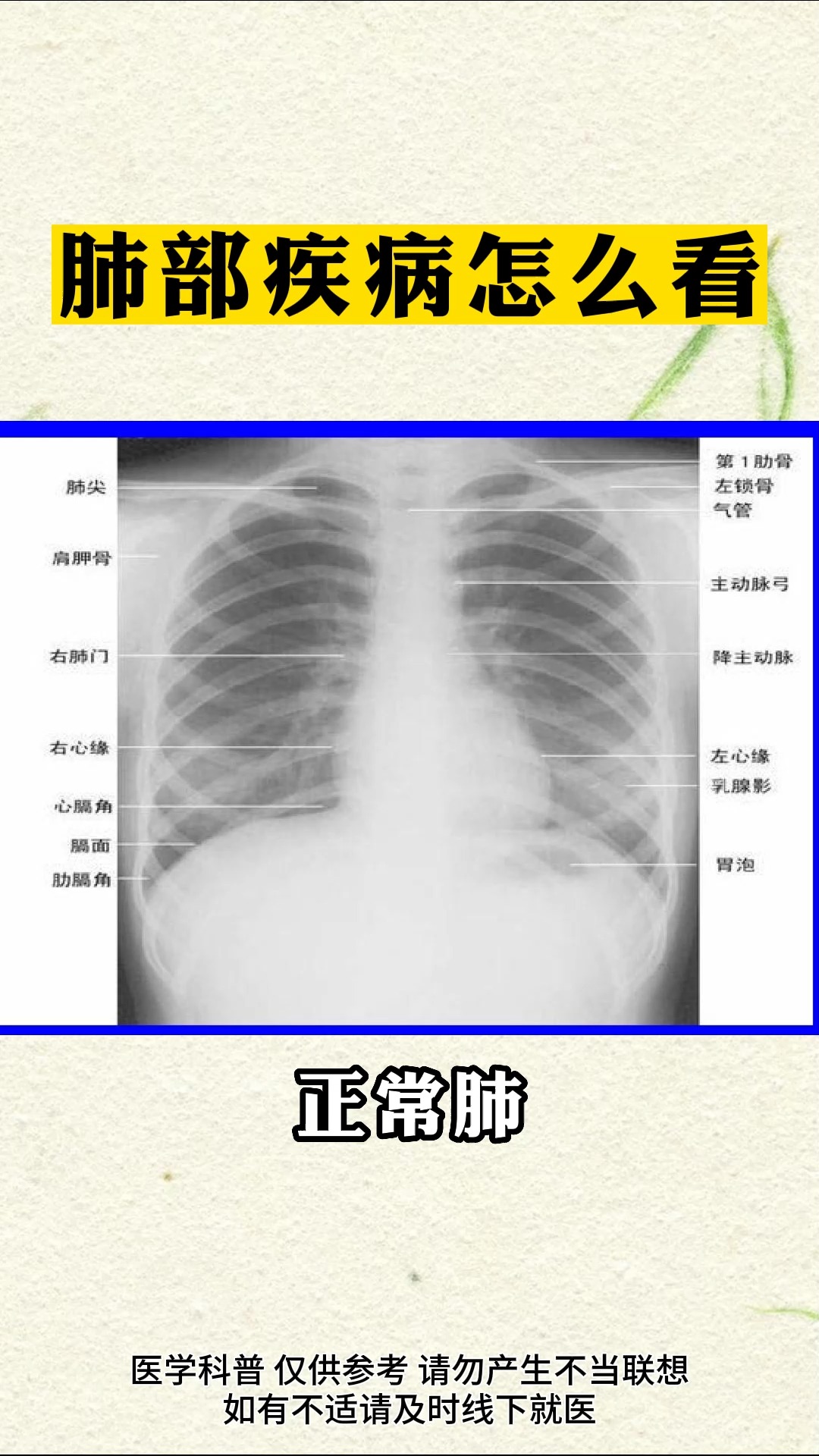 肺部疾病怎么看 