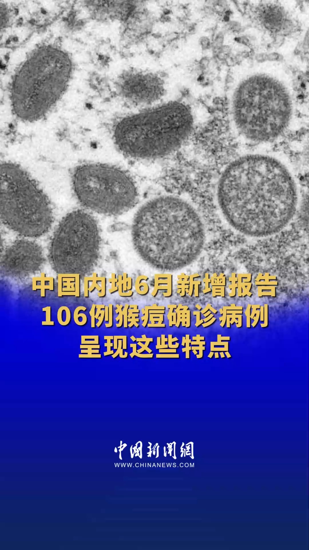 中国内地6月新增报告106例猴痘确诊病例 呈现这些特点