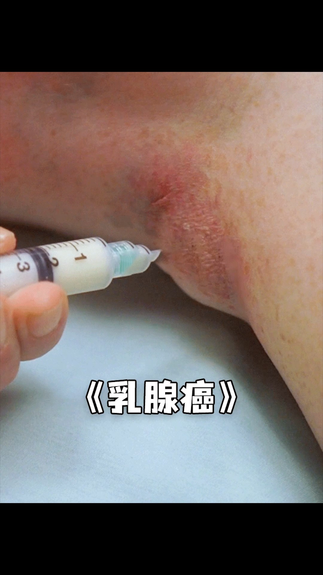 女人的小腿居然分泌出了乳汁,什么情况?#电影 